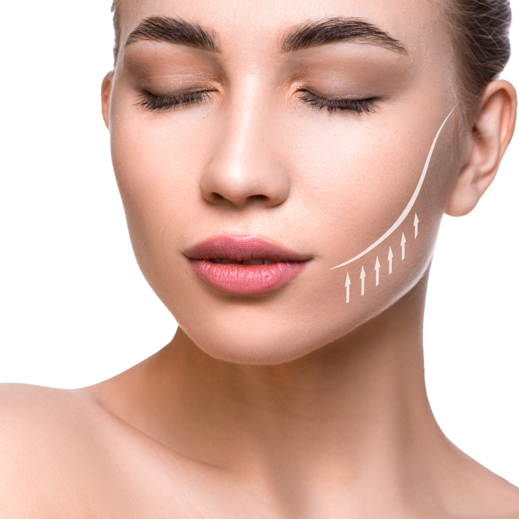 Tratamiento con Hilos Aptos Excellence Visage
