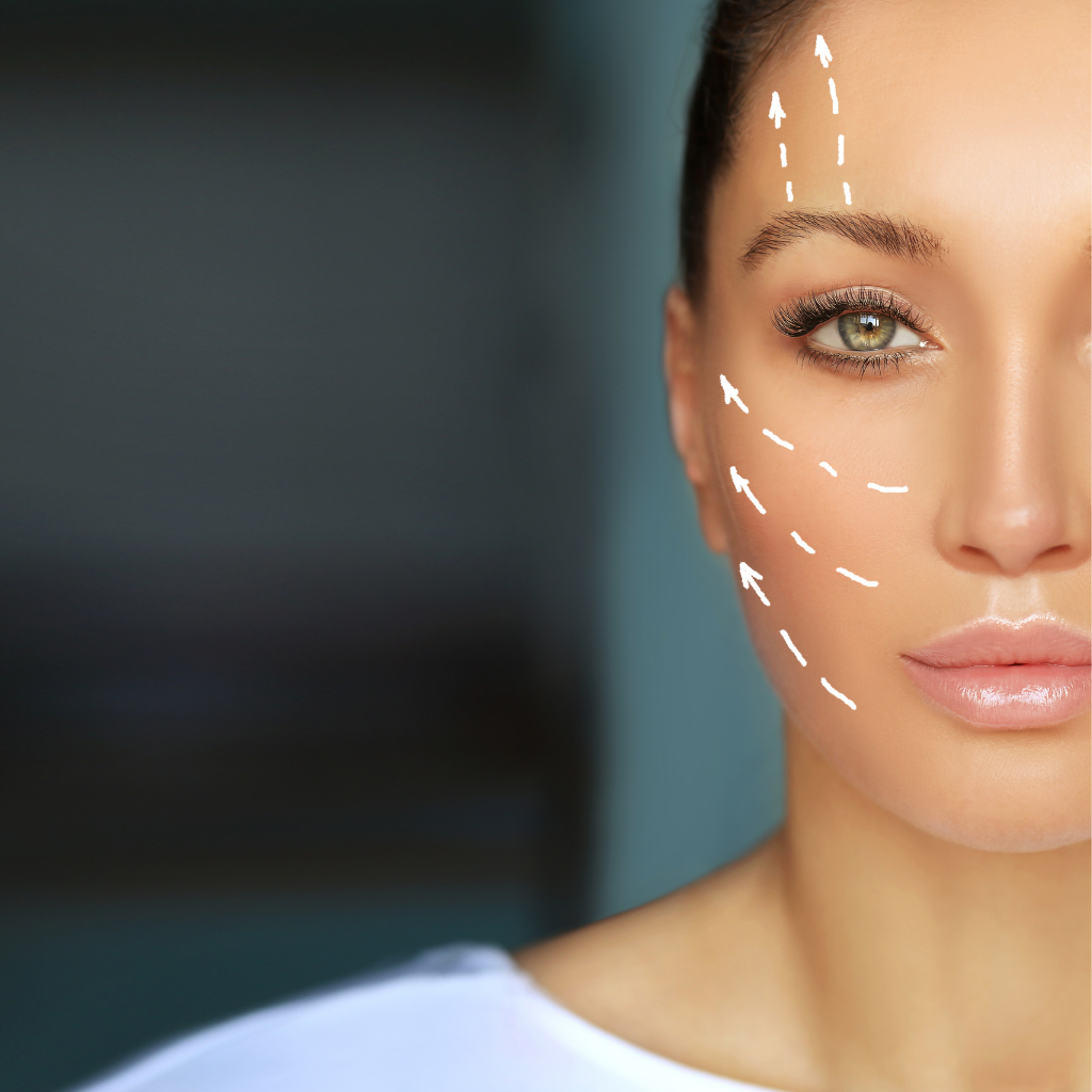 Hilos Aptos: rejuvenece tu rostro y dale un efecto lifting natural